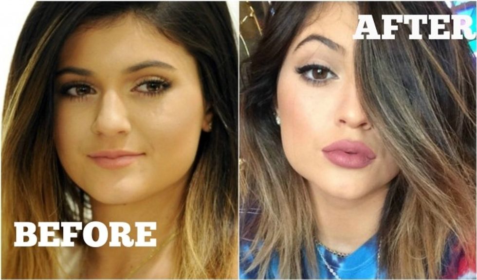 kylie 2