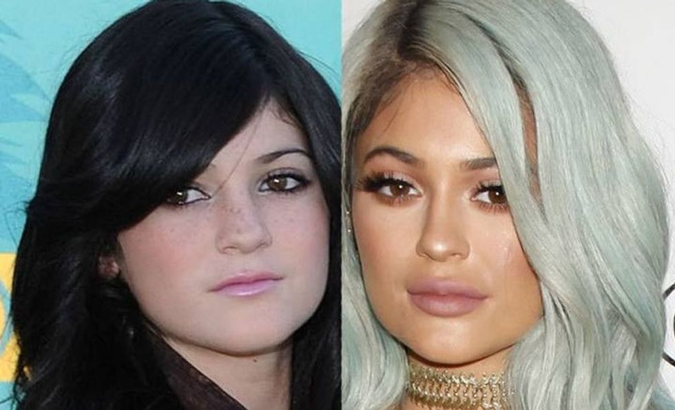 kylie2