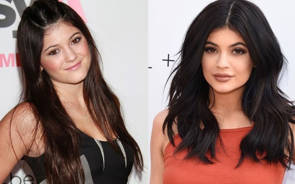 Kylie5