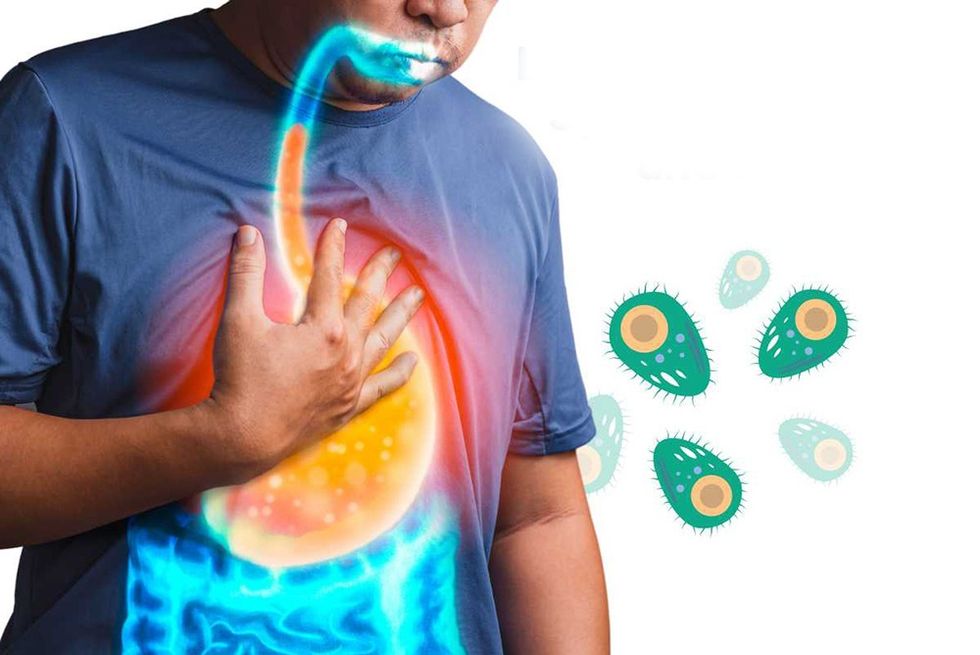 Legionnaire Disease Symptoms Causes and treatment