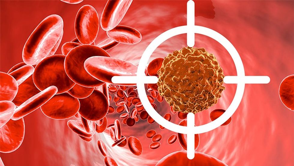 Leukemia Genetic Testing