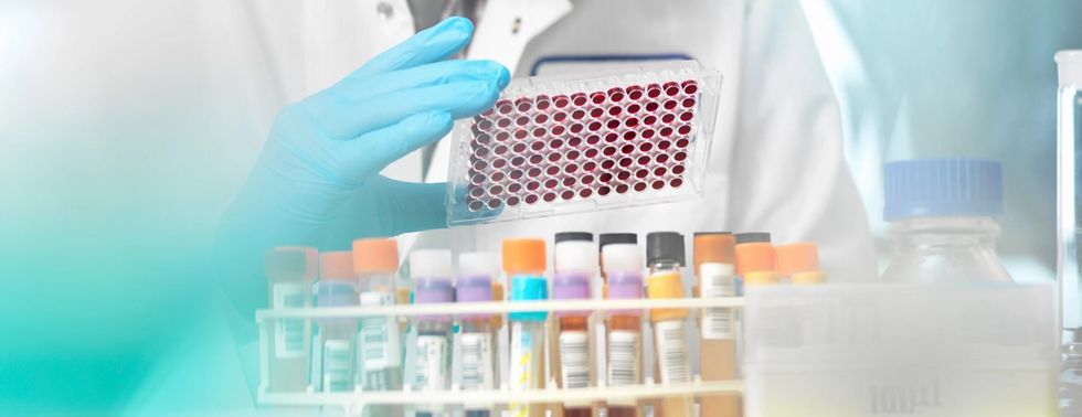 lipase test 2x scaled