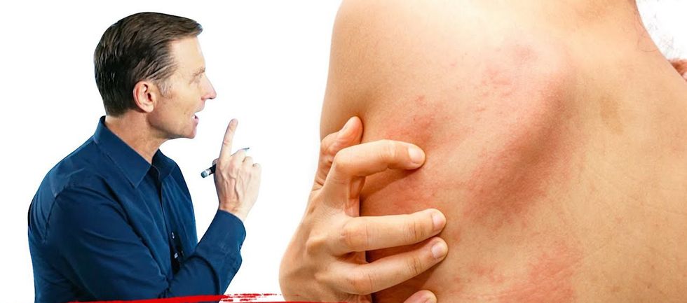 livewellgx immuwellgx histamine2