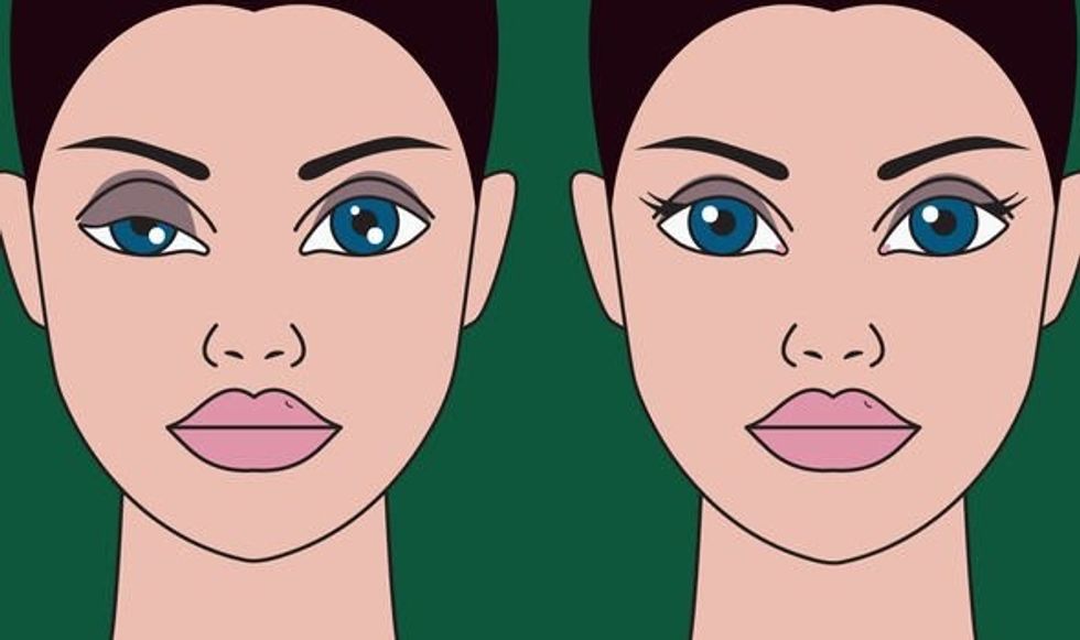 Lung cancer symptoms The sign in your eye which could signal the deadly disease 2196449 1