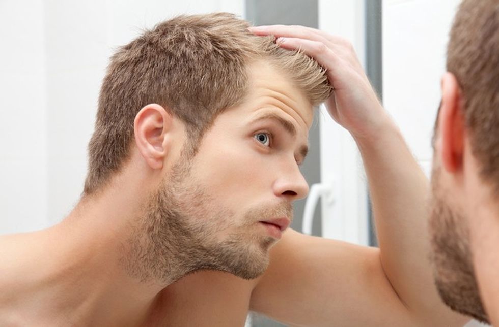 male hair loss article