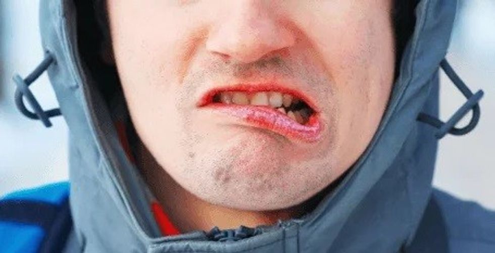man lips chapped