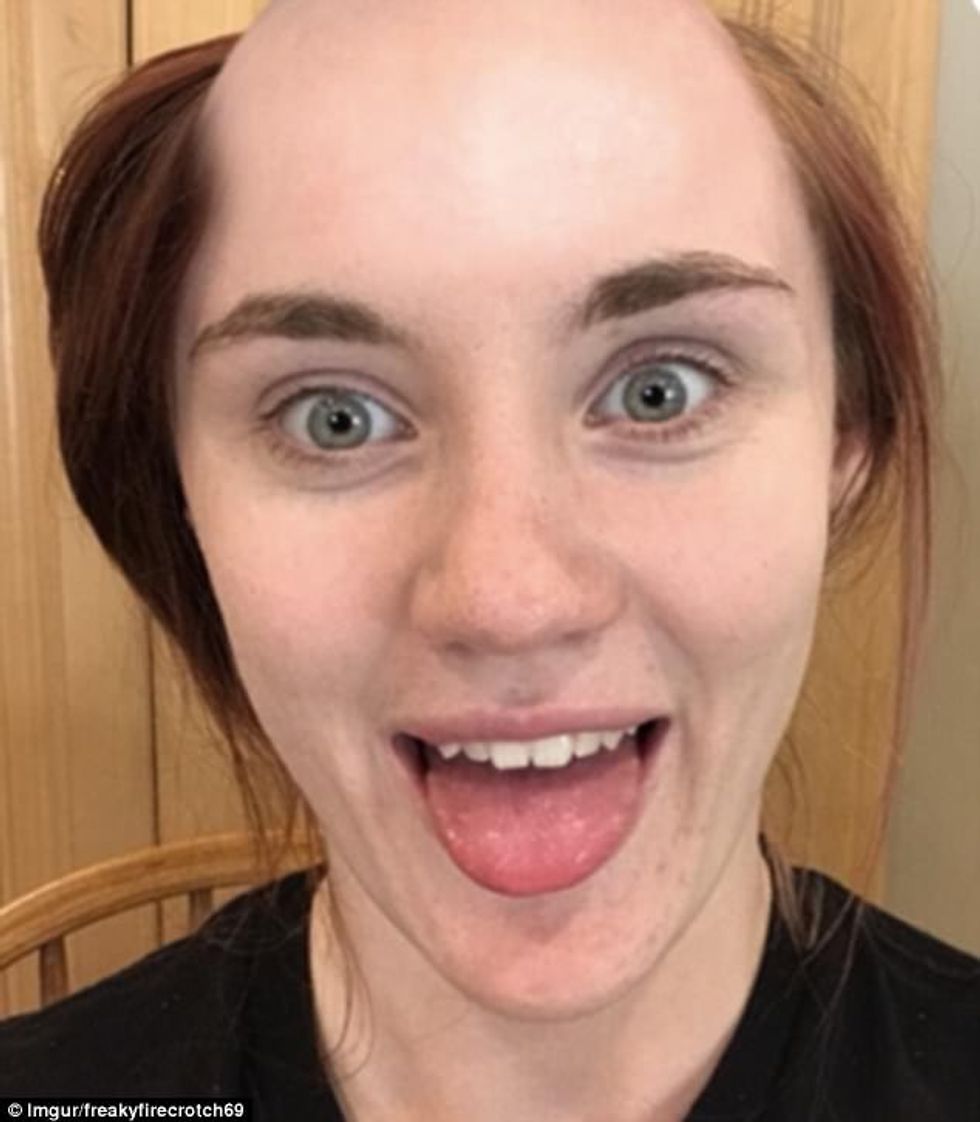 Mashtron të dashurin se ka rruar kokën reagimi tij eshte i papritshem foto 2