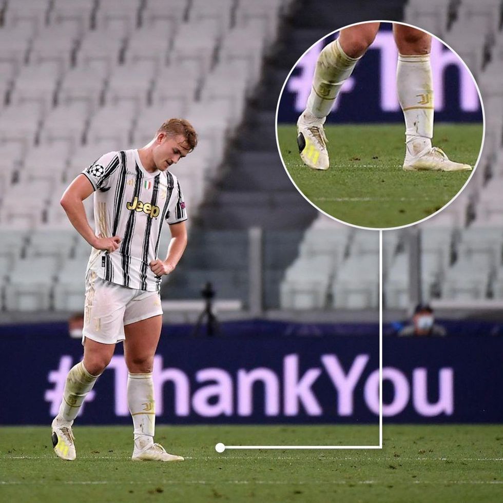 matthijs de ligt adidas scarpini boots cleats juventus rotto scotch outpump 1 1