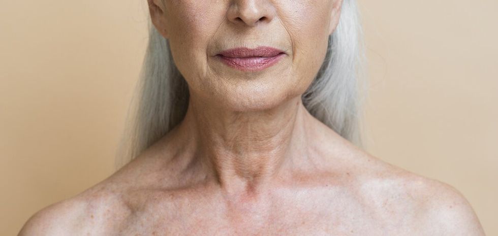 maturewomanskinchemicalpeelsundamage