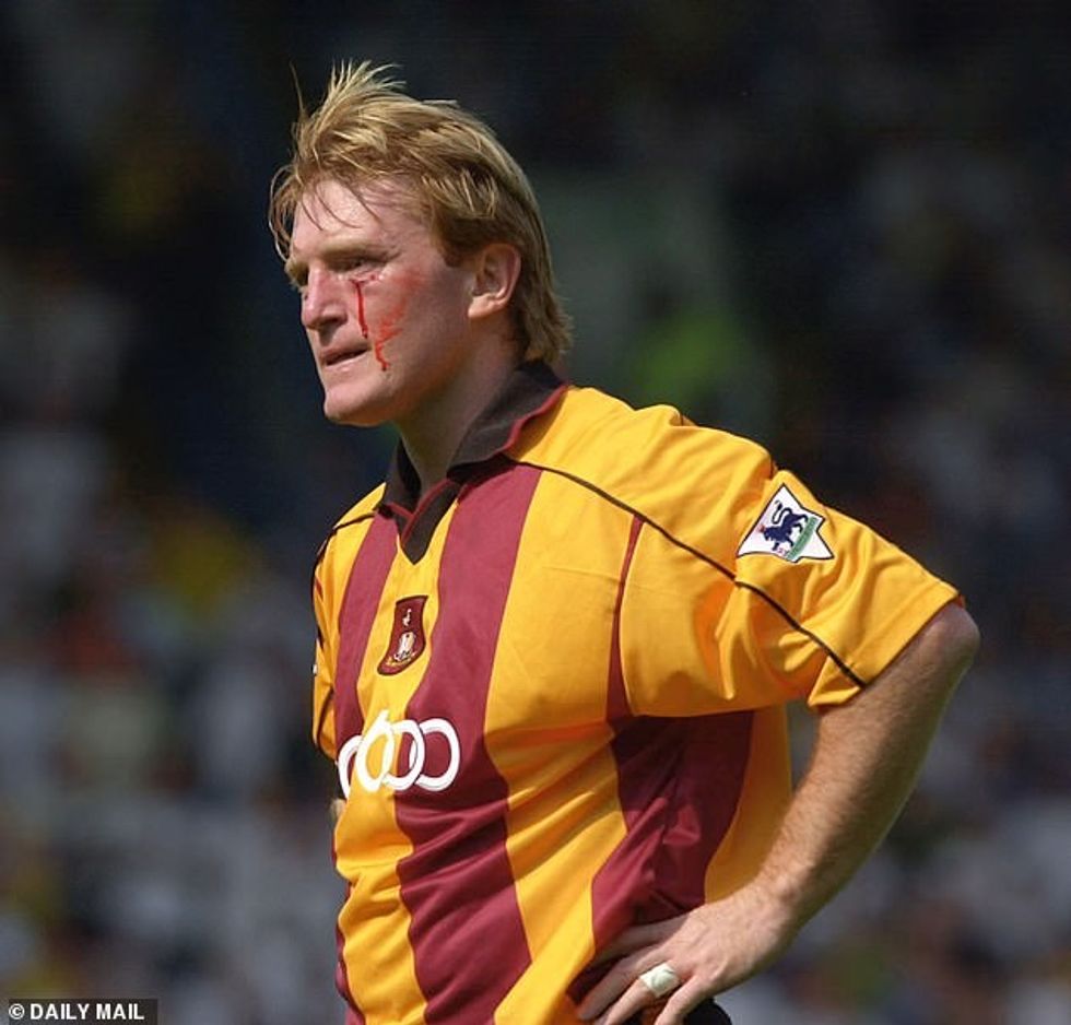 McCall was left with blood flowing from where Myers connected just below his eye