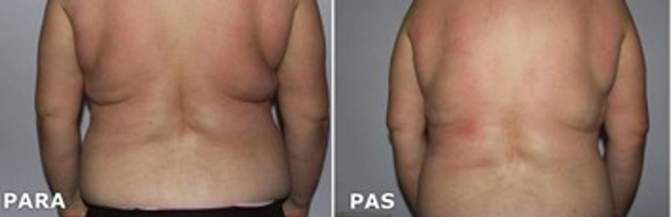 med contour telegraf 2