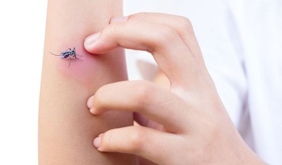 Mosquito Bite Itch Arm Scratch. q80 crop smart