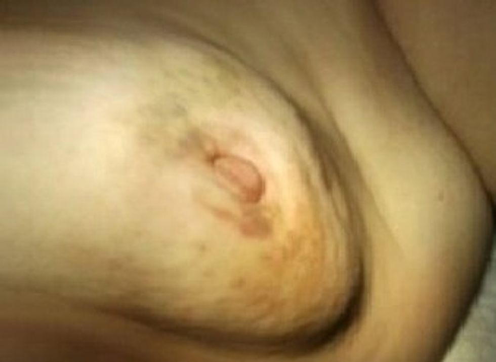 Ndryshime ne thithen e gjirit 123