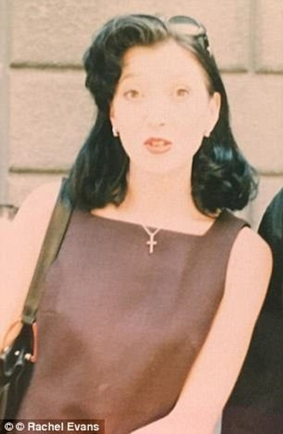 Ndryshon pamjen me anë të intervenime kirurgjike qe te duket si kukull foto 2