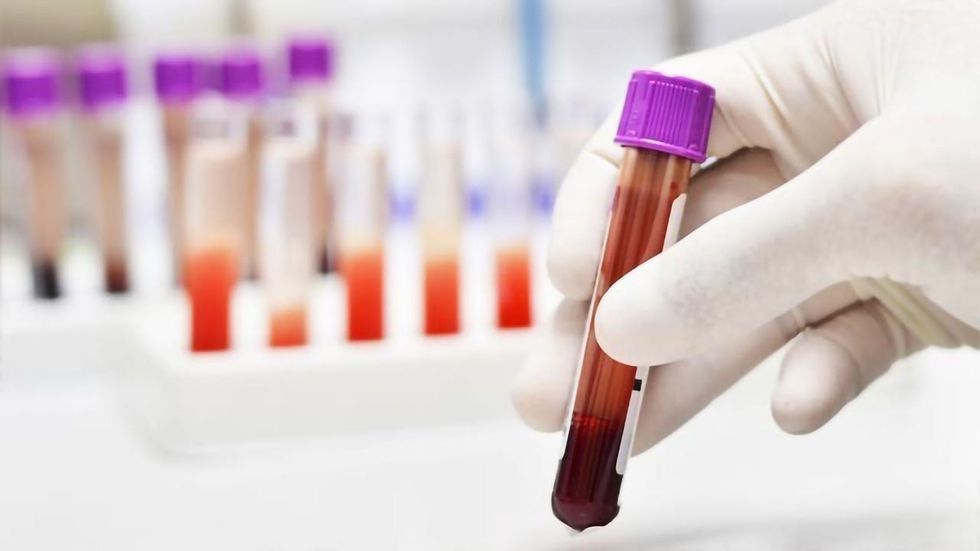 new blood test can detect cancer four years before conventional diagnosis methods 337706 1
