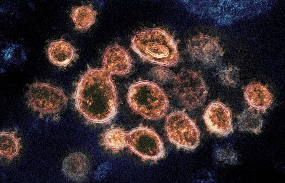NIH COVID coronavirus