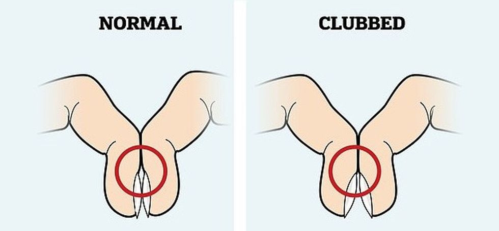 NINTCHDBPICT000542793364