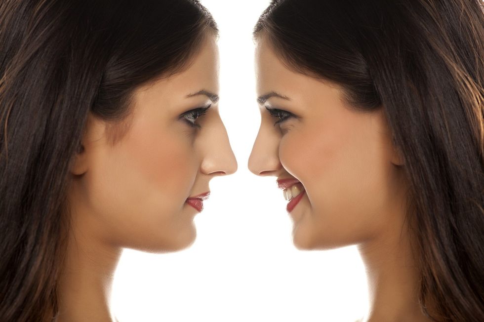 non surgical rhinoplasty e1527687672351