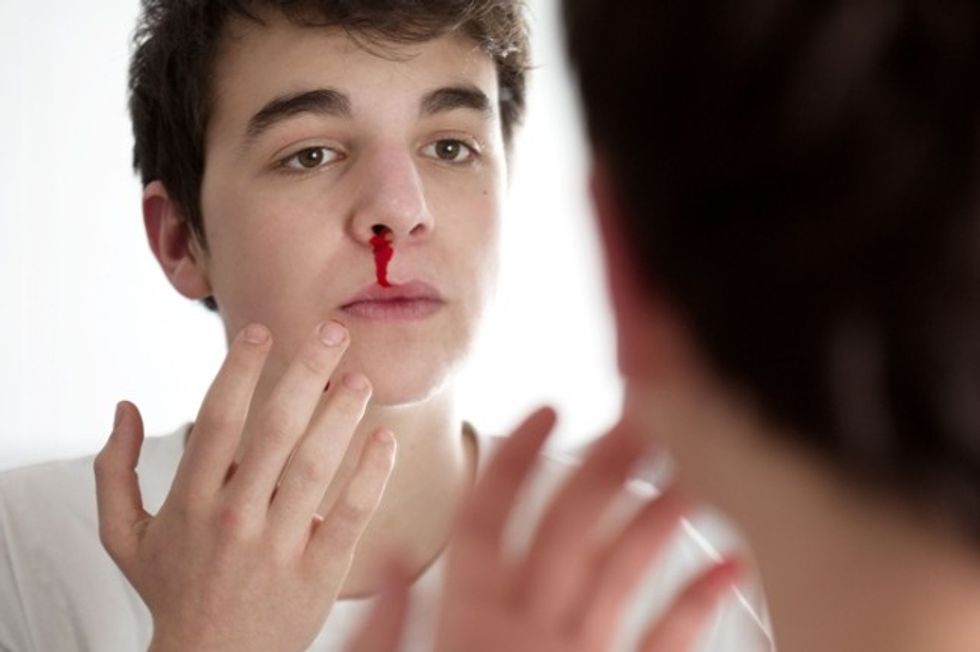 nose bleeding astrahealth center