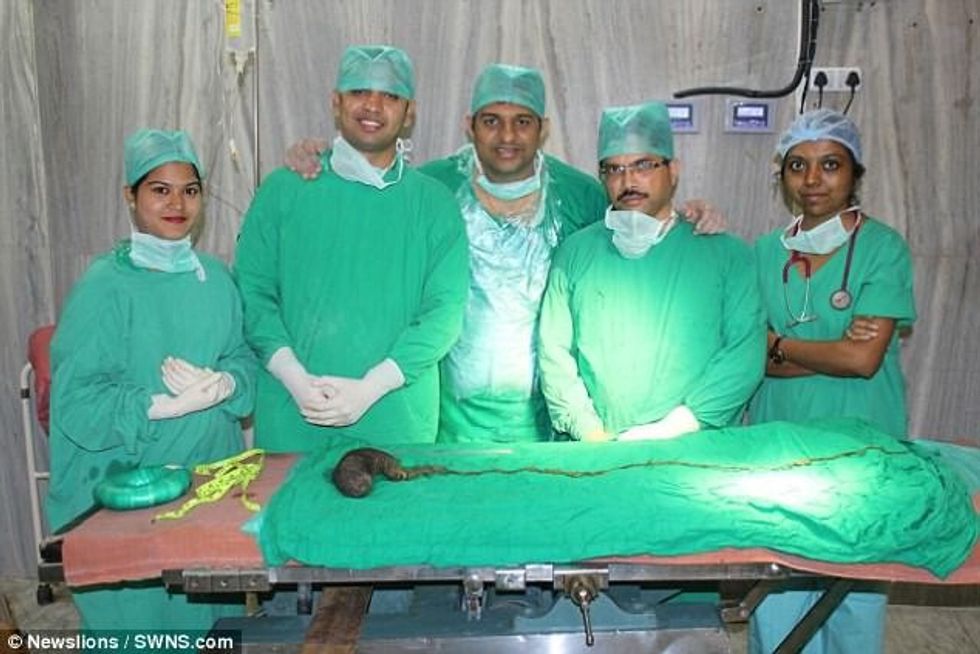 Nuk ndalonte së ngrëni flokët e veta mjeket i nxjerrin lemshin prej nje kilogrami foto