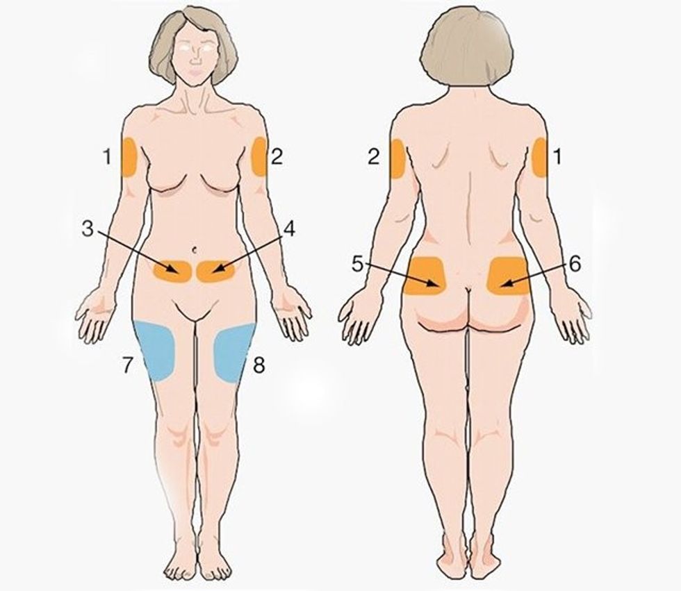 nursing notes nursing tips