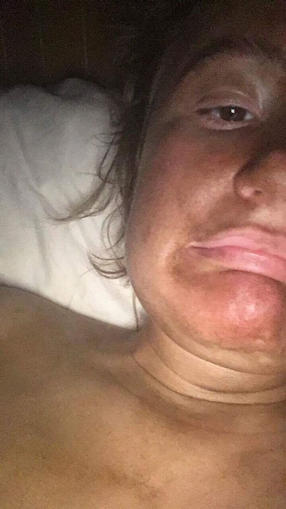 Nxirja artificiale nuk shkoi si duhet qendroi nje jave mbyllur se dukej keq foto 2