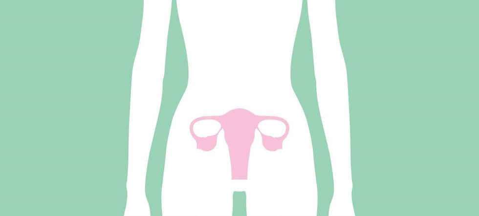 ovarian cancer illustration lg