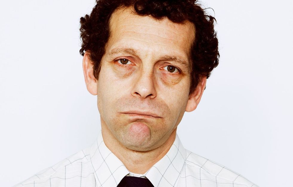 p 1 dark circles under the eyes 1519767176