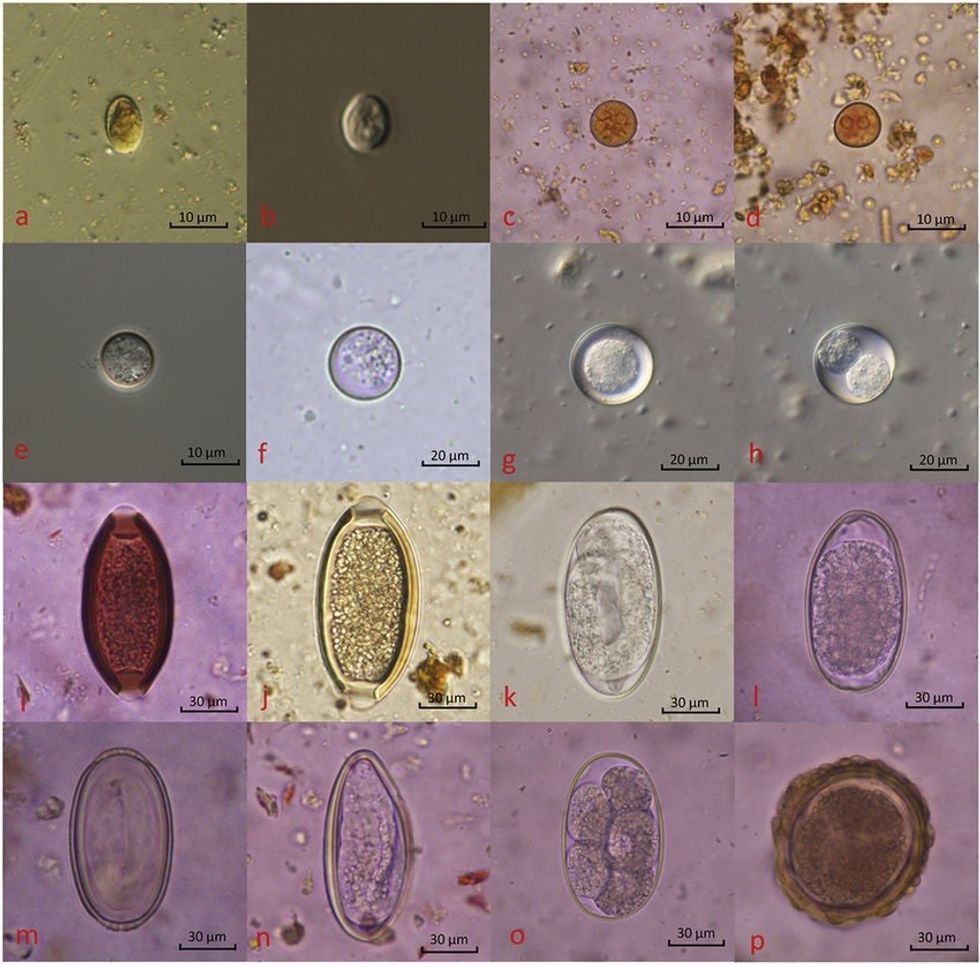 Parasites identified in stool sampl
