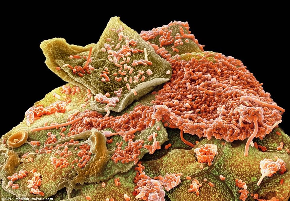 Pasi ti shihni keto fotografi me nuk do te flini pa i lare dhembet foto 7