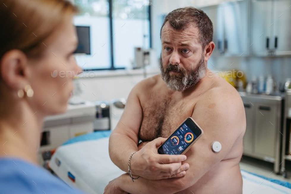 patient connecting continuous glucose monitor with smartphone to check his blood sugar level in real time obese overweight man is at risk of developing type 2 diabetes concept of the health risks of ov