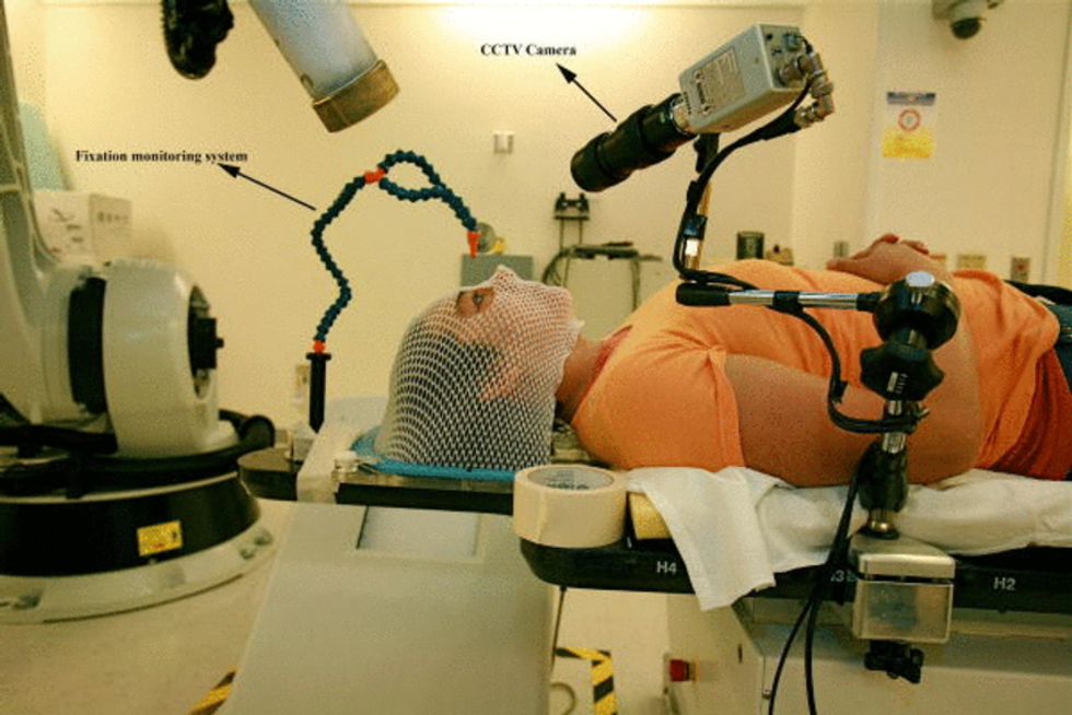 Patient position for CyberKnife treatment of an orbital tumor The patient is looking at
