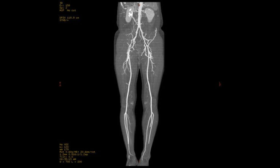 Periferni arterii ZMC
