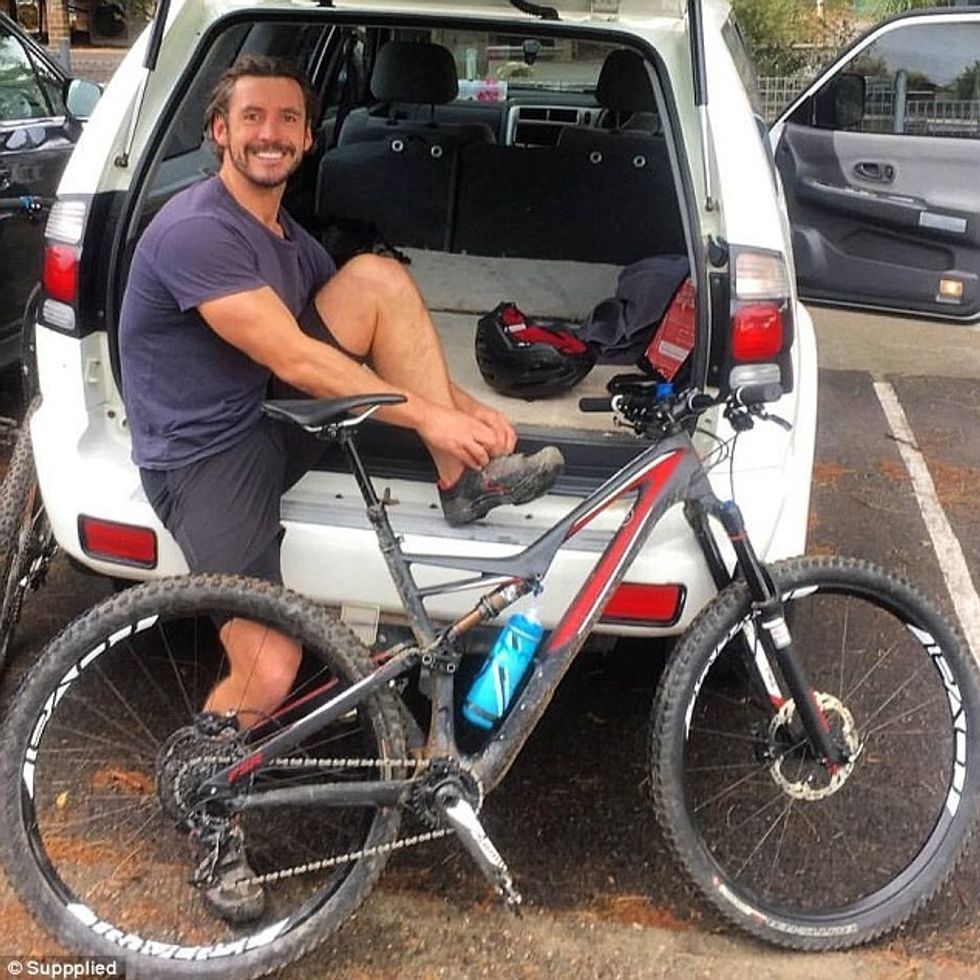 Pëson djegie të shkallës së tretë pasi i eksplodon iPhone dhe i kapet per trup foto 5