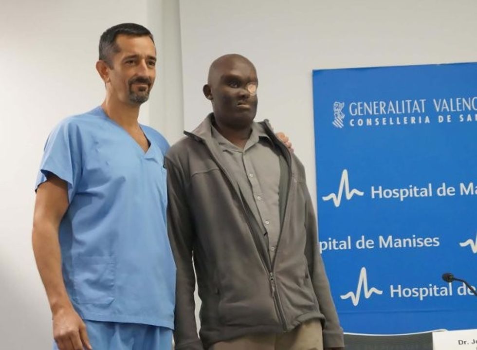 Pic shows: Mike Koech and Pedro Cavadas (Mike is seen here after the surgery);nnA man with an astonishing facial tumour almost the size of his head is recovering after a series of operations to remove it.nnThe giant tumour was so large it had blinded Kenyan-born Mike Koech in one eye and threatened to kill him as it continued to grow.nnSpanish surgeon Pedro Cavadas, 51, has told how if it had not been operated on it would have continued to grow and Koech would have