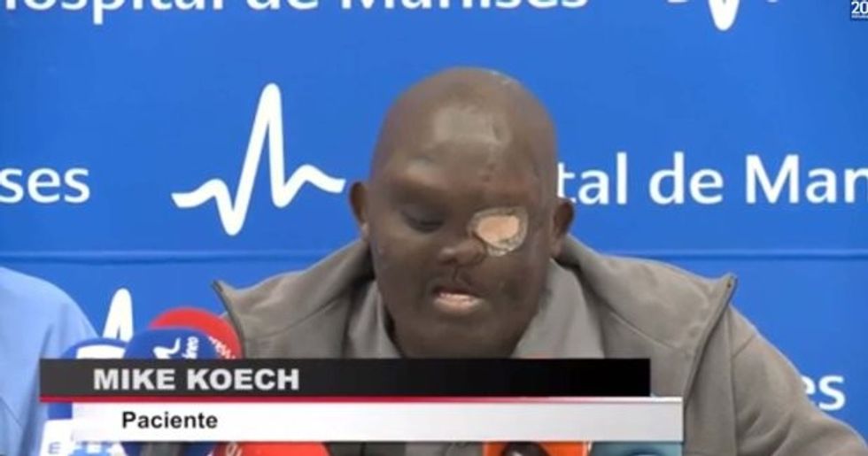 Pic shows: Mike Koech speaking at the conference (after surgery); A man with an astonishing facial tumour almost the size of his head is recovering after a series of operations to remove it. The giant tumour was so large it had blinded Kenyan-born Mike Koech in one eye and threatened to kill him as it continued to grow. Spanish surgeon Pedro Cavadas, 51, has told how if it had not been operated on it would have continued to grow and Koech would have