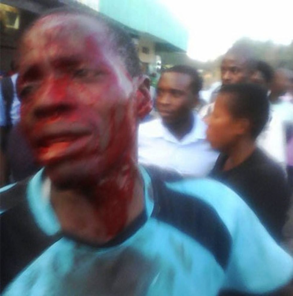 Pic shows: Moses Mushonga, the victim. A prostitute whacked a customer on the head with a beer bottle after he put his hands on her breast, and then asked if he could pay for sex with a boiled egg. The man told her he had just spent the last of his money on buying two boiled eggs costing 25 cents each. He had already eaten one when he spotted the woman offering sex on the side of the road in the town of Mvurwi in Mashonaland Central province in Zimbabwe. But when Moses Mushonga asked about the price, the woman flew into a rage when he suggested he pay using his remaining boiled egg. She had hit him with the beer bottle, and then punched him in the face knocking him flat for good measure. The attack by the furious 23-year-old, identified only by the name Chipo, left the 28-year-old victim bleeding heavily from his head. He was quoted in local media saying: