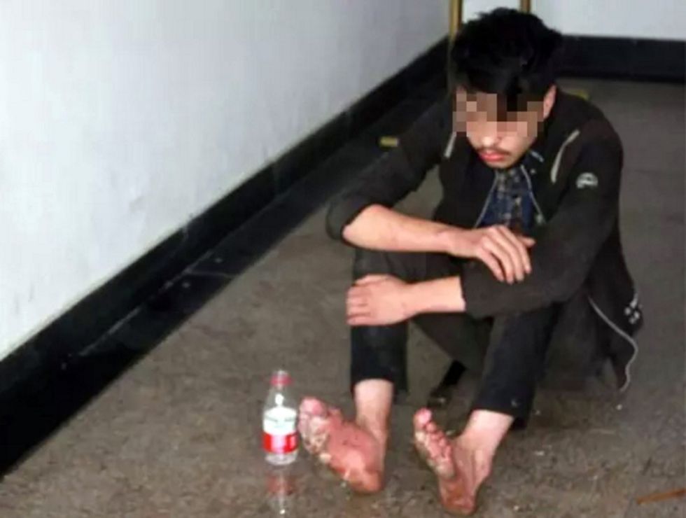 Pic shows. The gamer in a police station. Police rescued a teenager who was so addicted to online gaming he let his feet rot when he went on a six-day binge at an internet cafe and forgot to wash or feed himself and later collapsed. The unnamed man, aged 19, had apparently run away from home in order to go on the bizarre and dangerous gaming adventure, with his own father even reluctant to take him home. Authorities in Hangzhou, capital of East Chinas Zhejiang Province, reportedly came across the young gamer after he was spotted lying unconscious behind the shrubs of a railway track. He was found with bleeding and infected feet, which had festered and which let off a putrid smell. The man only woke briefly to ask for water as he was dragged back to the police station for some basic medical attention. He told authorities that he had not eaten for three days, having spent all his money on a six-day, non-stop gaming spree at the internet cafe. It was clear that he had not taken a shower during the time either, which is thought to be the main contributing factor to his rotting feet. Reports said the gamers own father initially told officer that he did not want his son back, claiming that the teenager ran away from home 10 days ago and did not care for anything else besides online gaming. But after some consideration the dad asked for his son to be sent back to him. Officers said they were concerned for the young man because his foot infection could have killed him if he had not been found in time. (ends)