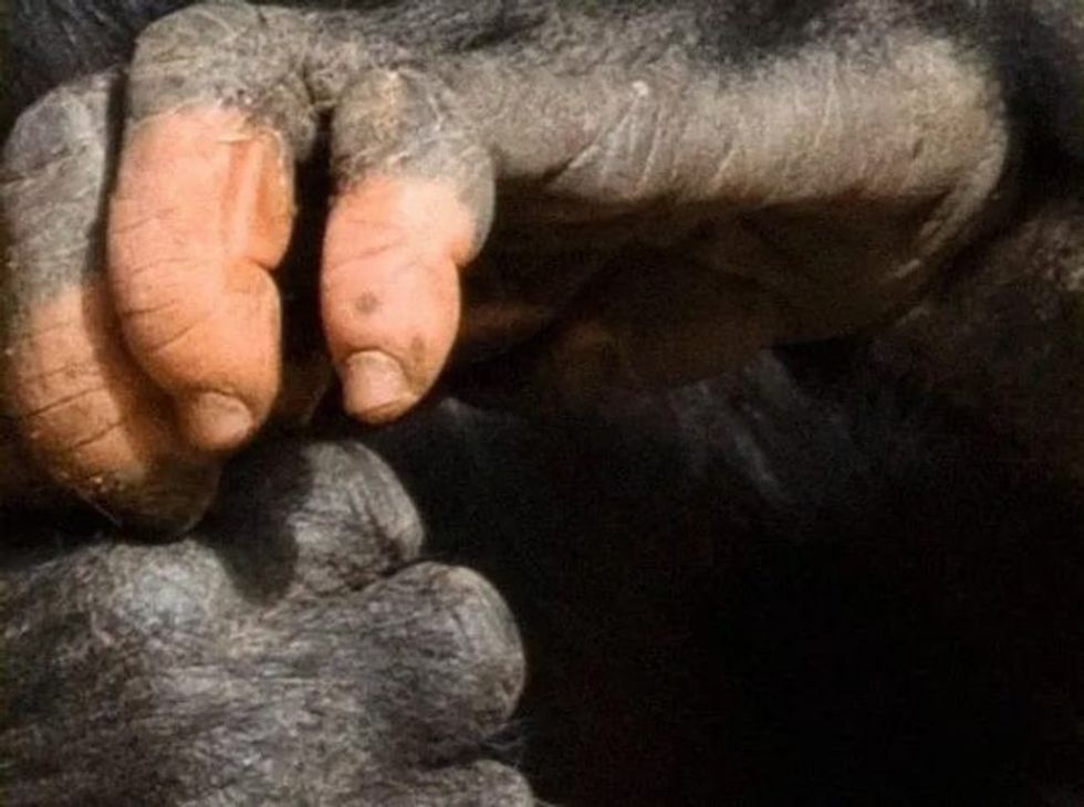 picture of gorilla with lack of pigmentation proves how strong our similarities are5 1