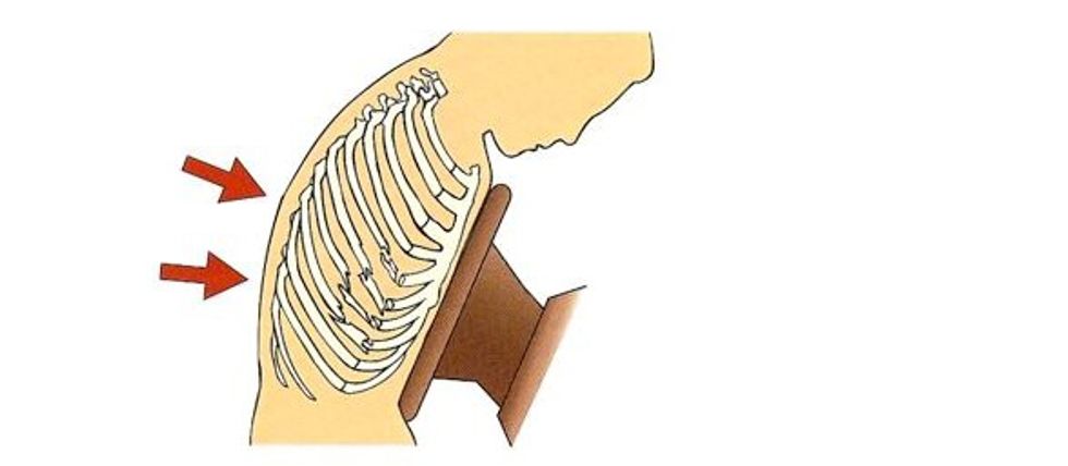 Plage hapur e kafazit te kraharorit