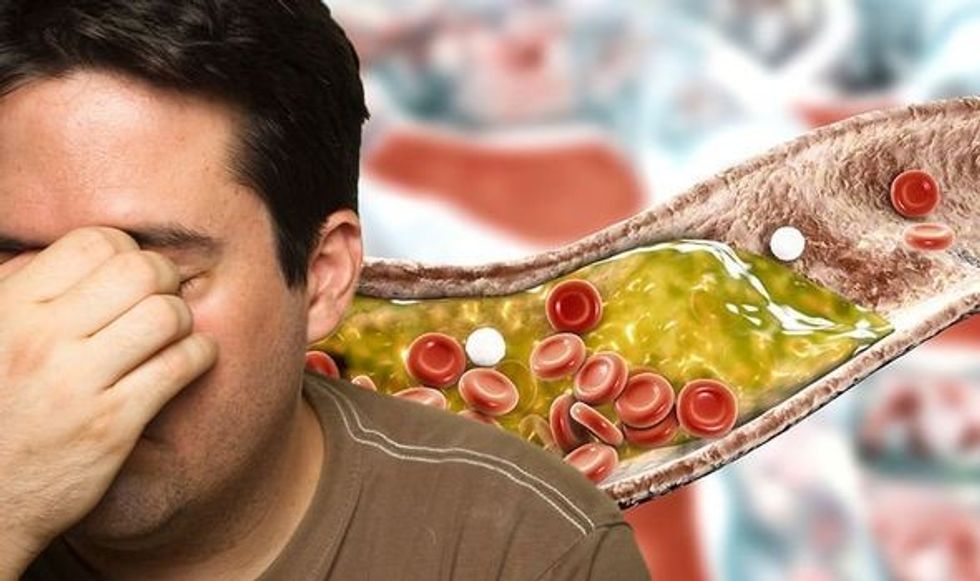 Plaques nose 1453277