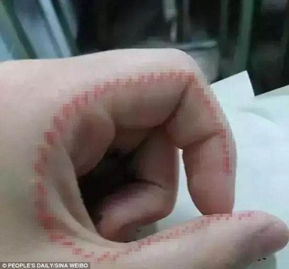 Platforma e ngjashme me Balenen e Kalter detyron femijet te bejne qepje ne lekuren e tyre foto 3