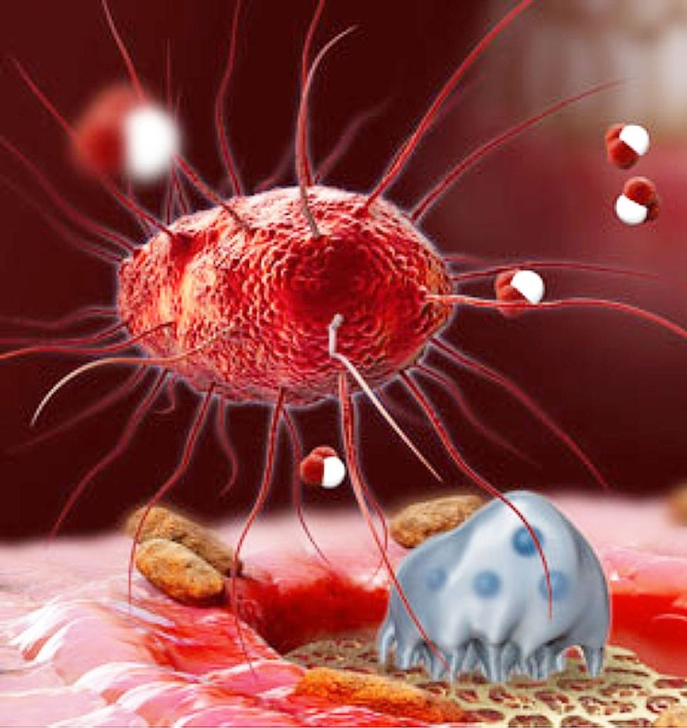 Porphyromonas gingivalis2