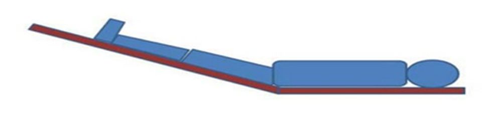 pozita autotransfezive