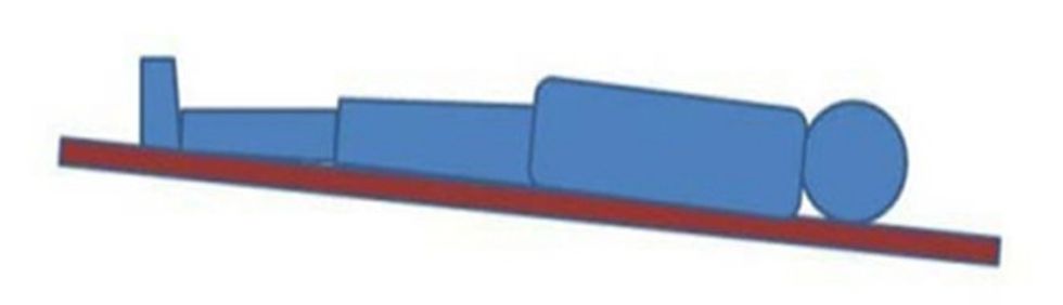 pozita e trendelenburgut