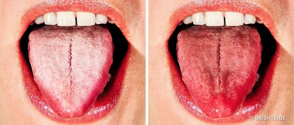 preview 21106360 99 1521842040