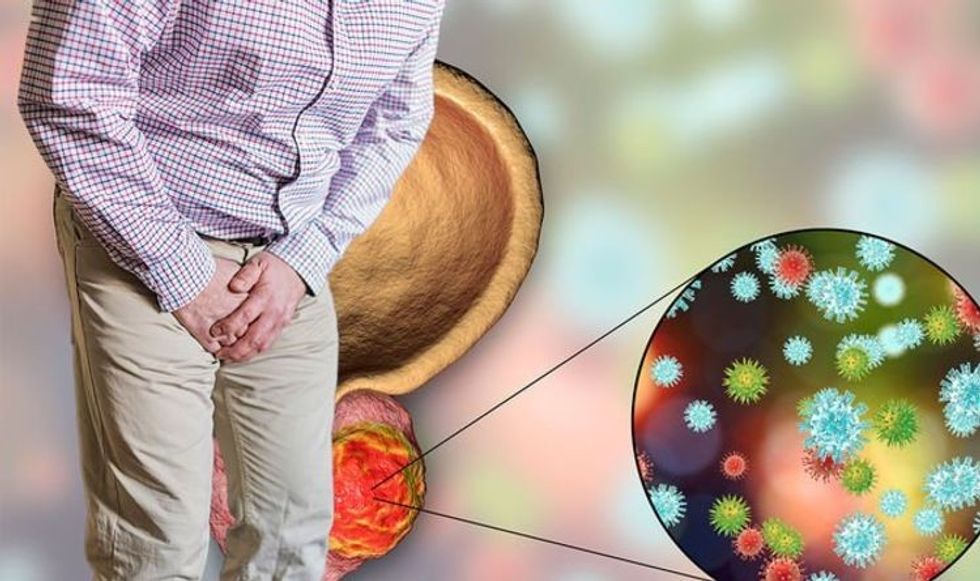 Prostate cancer symptoms The warning sign when you urinate