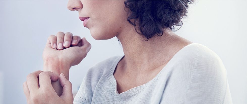 psoriasi cause prurito