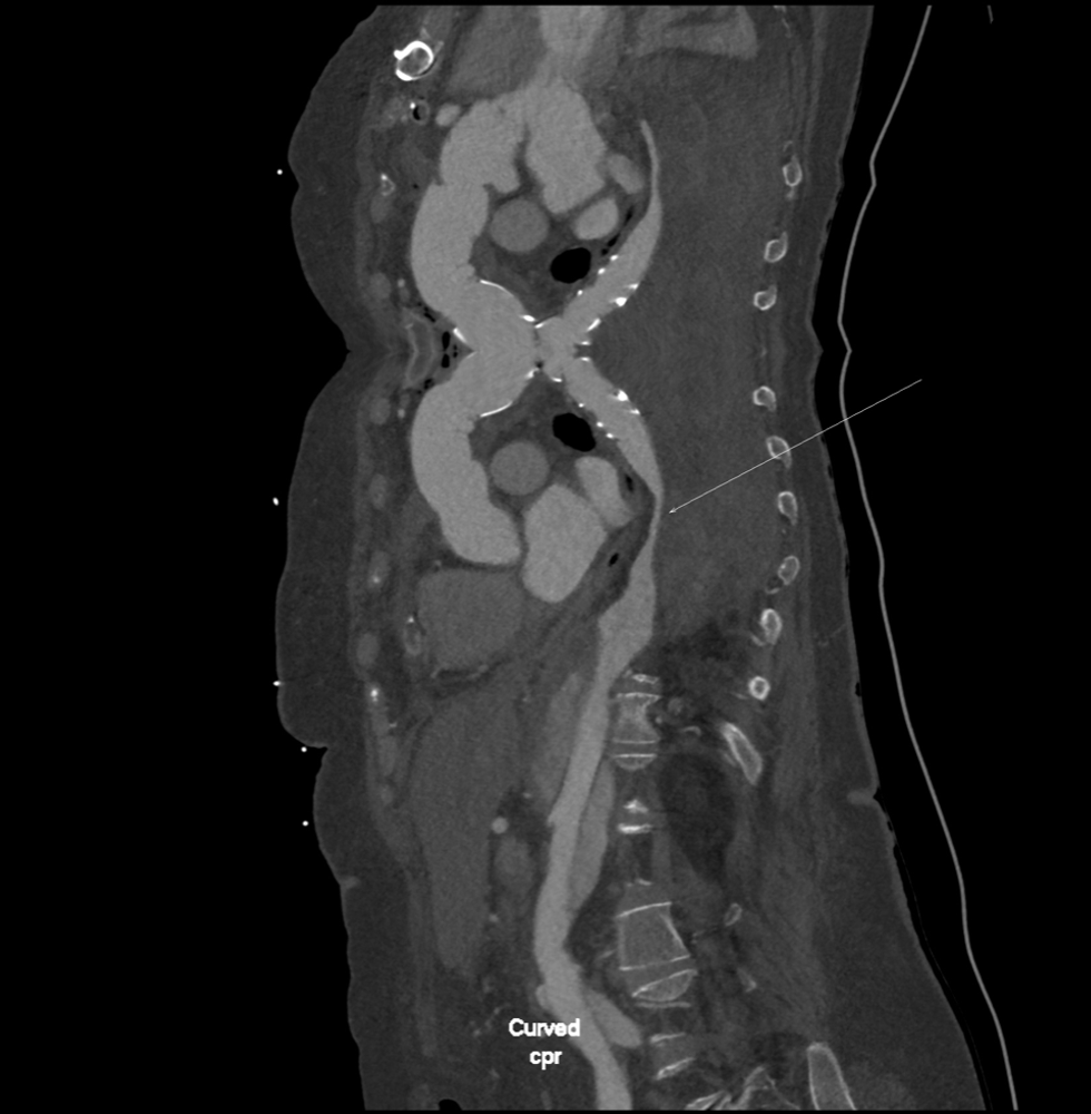 PX Img20230613094150 PostOp