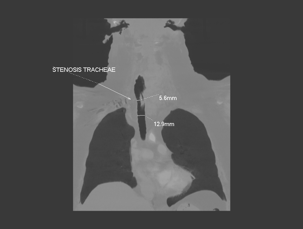 PX Img20231226095237